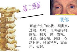每一块颈 胸 腰椎体受损会引起那些病