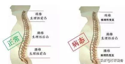一招缓解因久坐导致的腰痛是怎么回事,关于如何缓解因久坐引起的腰疼的新消息 多特软件资讯