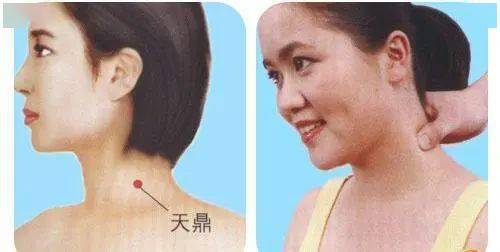 为何甲状腺结节偏爱女性 多半和这些因素有关,千万要注意