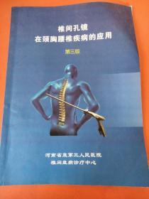 椎间孔镜在颈胸腰椎疾病的应用第三版