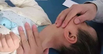 颈痛相关 自己不痛别处痛的胸锁乳突肌