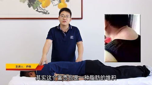 富贵包除了颈椎,胸椎 腰椎过多脂肪堆积也会形成富贵包,要注意