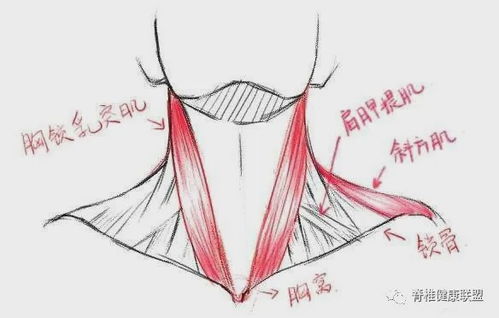 颈痛头痛最大的潜伏者 胸锁乳突肌
