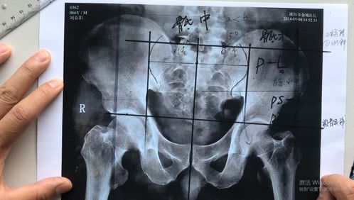 触诊.矫正术 颈椎 脊椎 腰椎 胸椎...