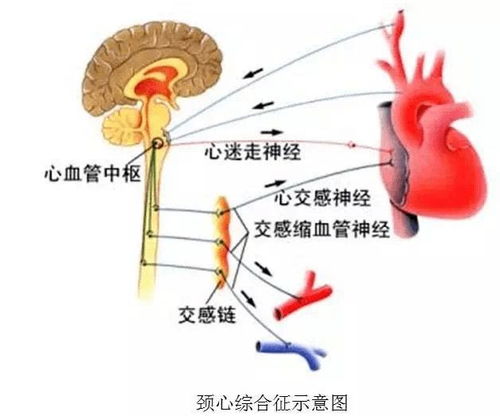 沈明球 心悸 胸闷 背痛,或是颈椎出了问题 交感神经