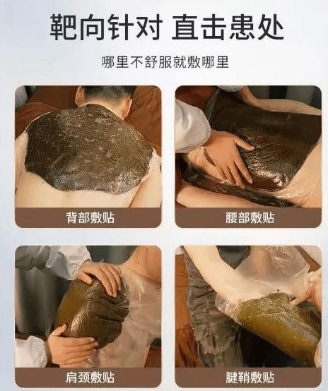 泥灸 热灸膏的区别