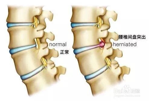 "小杰说"舒服的是心,伤的是我们的颈胸腰椎!