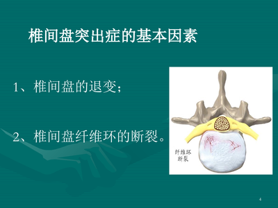 颈胸腰椎间盘突出症的微创治疗课件