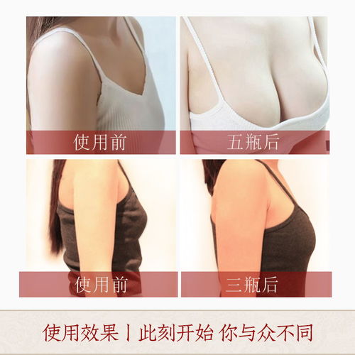 伊兰妍丰胸产品乳霜胸产后下垂缩水发育不良