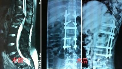 沈医附属中心医院脊柱外科(骨外四科)主任赵伟