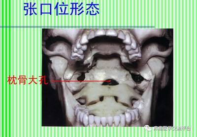 (上)脊柱解剖图(颈胸腰椎)