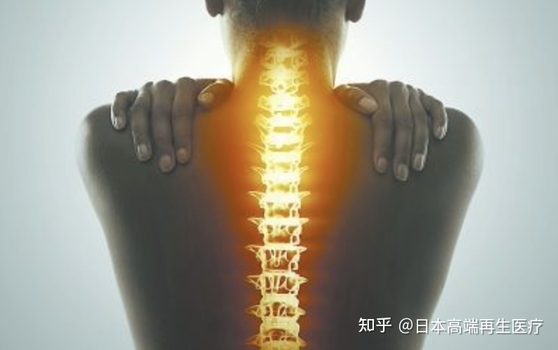 令周杰伦、张嘉译备受折磨的《癌亡灵》--强直性脊柱炎,干细胞帮您攻克!