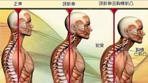 腰椎病多是坐出来的 医生忠告 这几个坐姿习惯没好处,尽快改掉