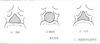 上 脊柱解剖图 颈胸腰椎