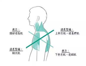 明星健康问题引关注 杨幂颈胸腰椎病的启示与应对