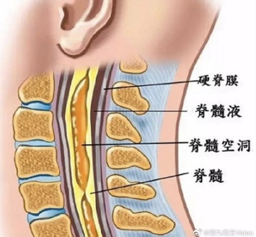 29岁美女作家因罕见病离世，去年8月确诊颈胸腰椎病