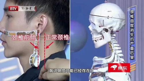 第一批90后的颈椎危机 这些动作正悄悄摧毁你的脊柱健康