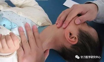 颈痛与胸锁乳突肌 当疼痛蔓延至胸腰部的警示