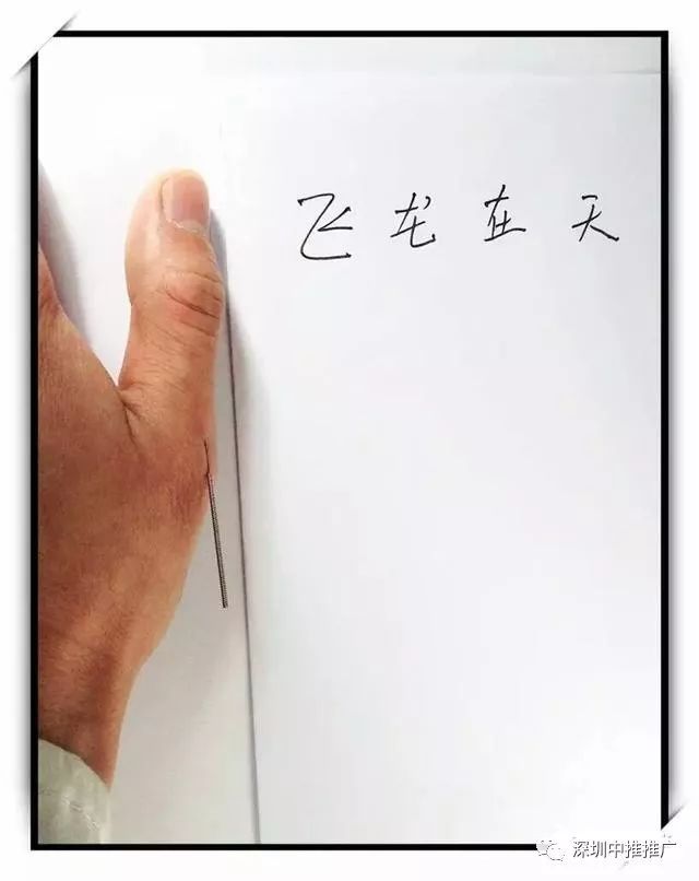 常春堂中医针灸班 快学快用阴阳九针,轻松应对颈胸腰椎病